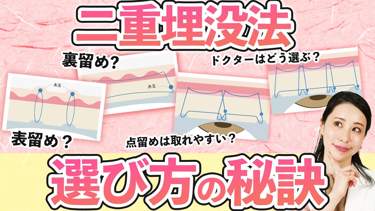 【二重埋没法】色々あるけど何が違うの？おすすめ施術とドクターの選び方を教えます！