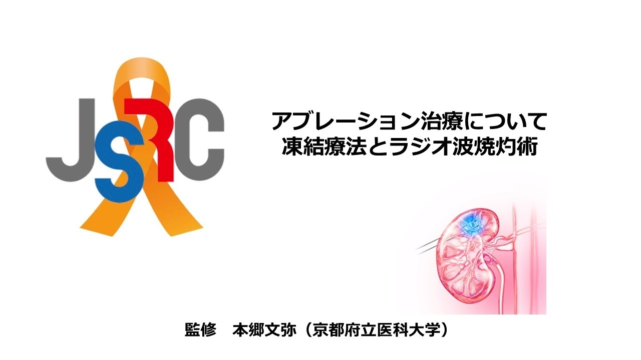 2026年3月腎癌啓発月間配信　～アブレーション治療について　凍結療法とラジオ波焼灼術～　京都府立大学　本郷文弥先生