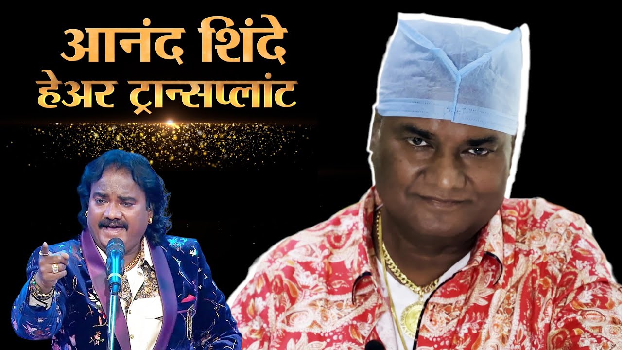 Anand Shinde Hair Transplant | Celebrity Hair Transplant |