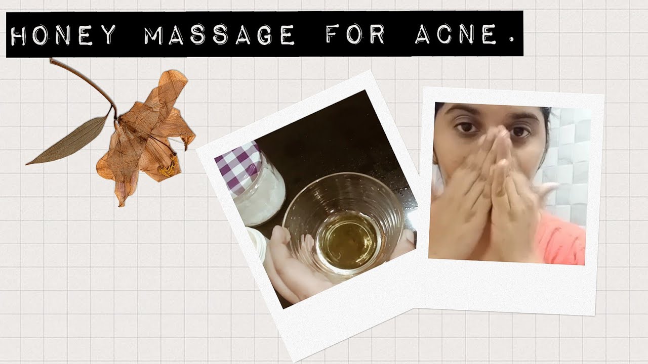 How to Use Honey To reduce Acne/Pimples/Boils Overnight.🍯