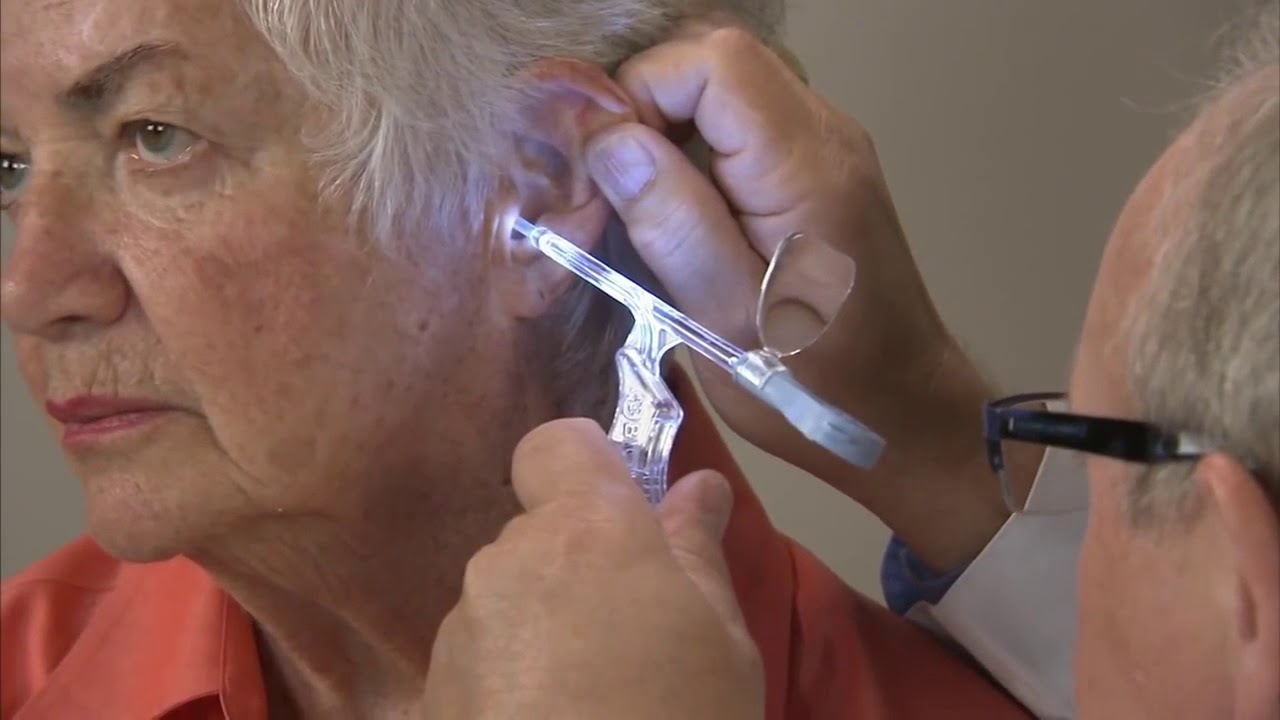 Lighted Suction for cerumen removal