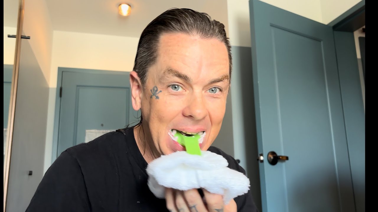 Casting SID WILSON's Teeth...