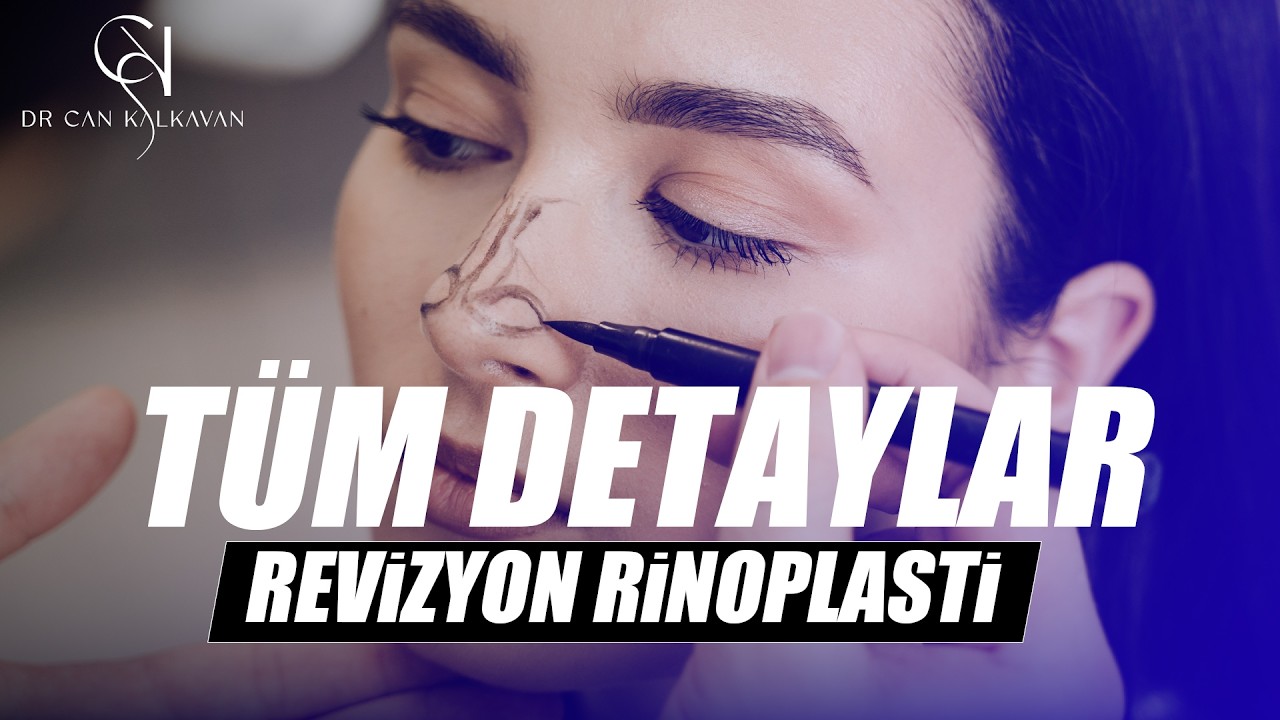 Revizyon Rinoplasti: İkinci Burun Ameliyatı Zor mu?