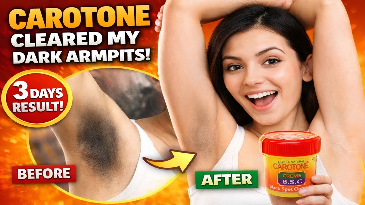 I Tried Carotone Cream For Dark Armpits
