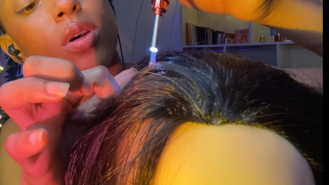ASMR TE BUSCO piojos y CASPA / Alexandra asmr