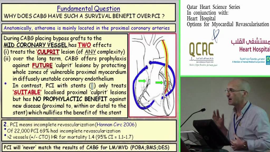 Surgery is Superior to PCI; lessons from the trials -  David Taggart