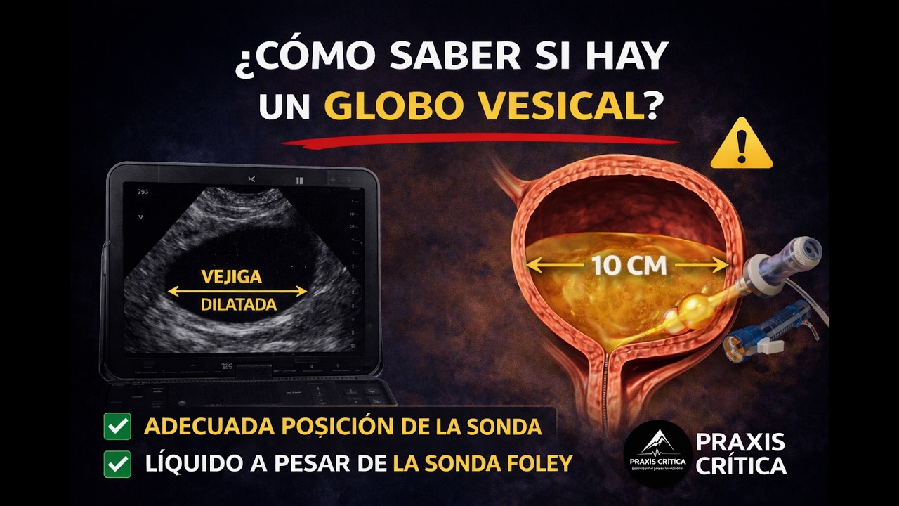 25. Determinación de presencia de globo vesical por Ecografia.