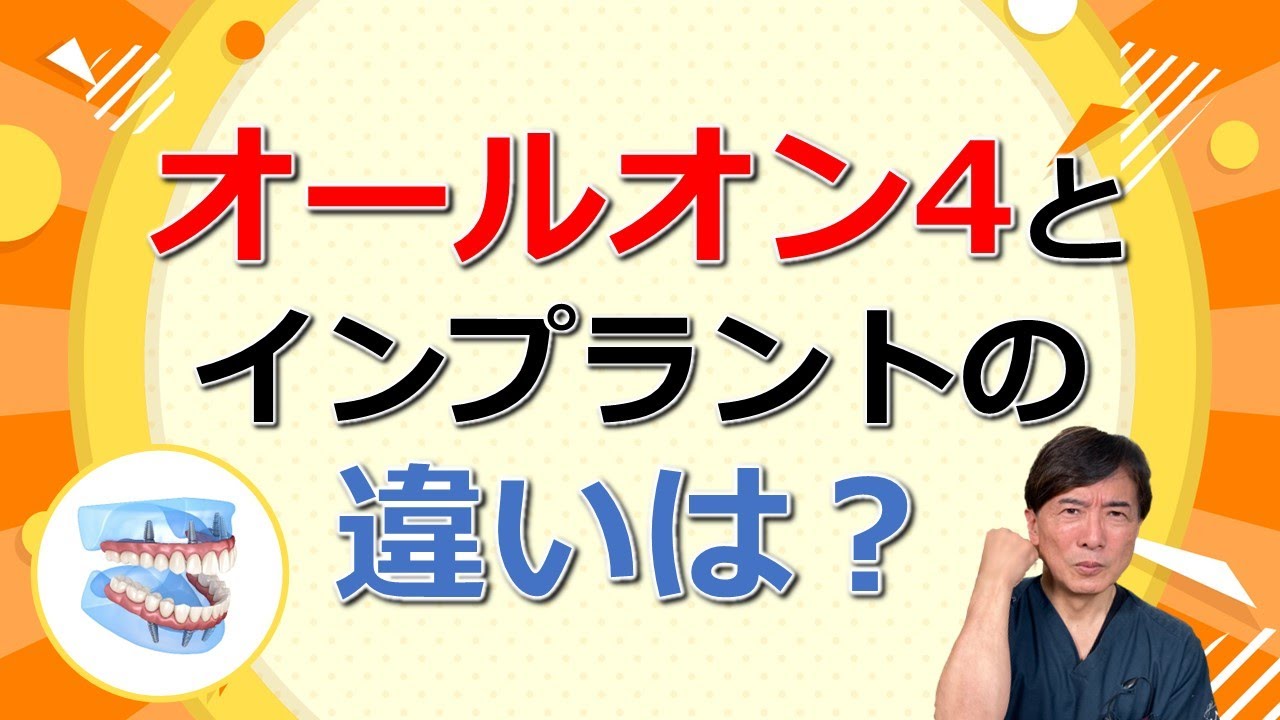 オールオン４とインプラントの違いは？