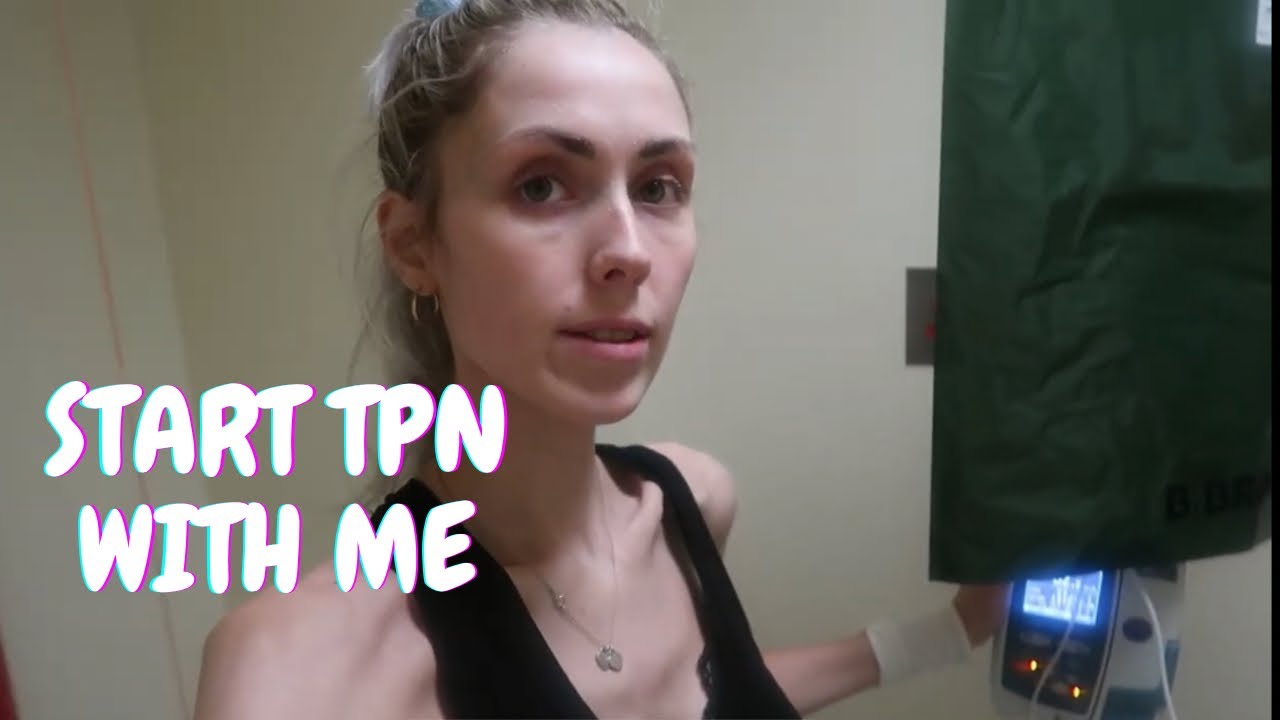 Start my TPN process with me | My TPN journey so far | PICC line insertion | TW: WEIGHT LOSS