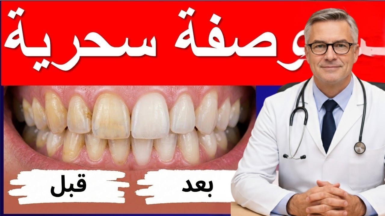 تبييض الأسنان في المنزل بطريقة