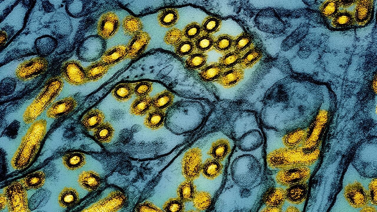 First person diagnosed with bird flu in Nevada made full recovery