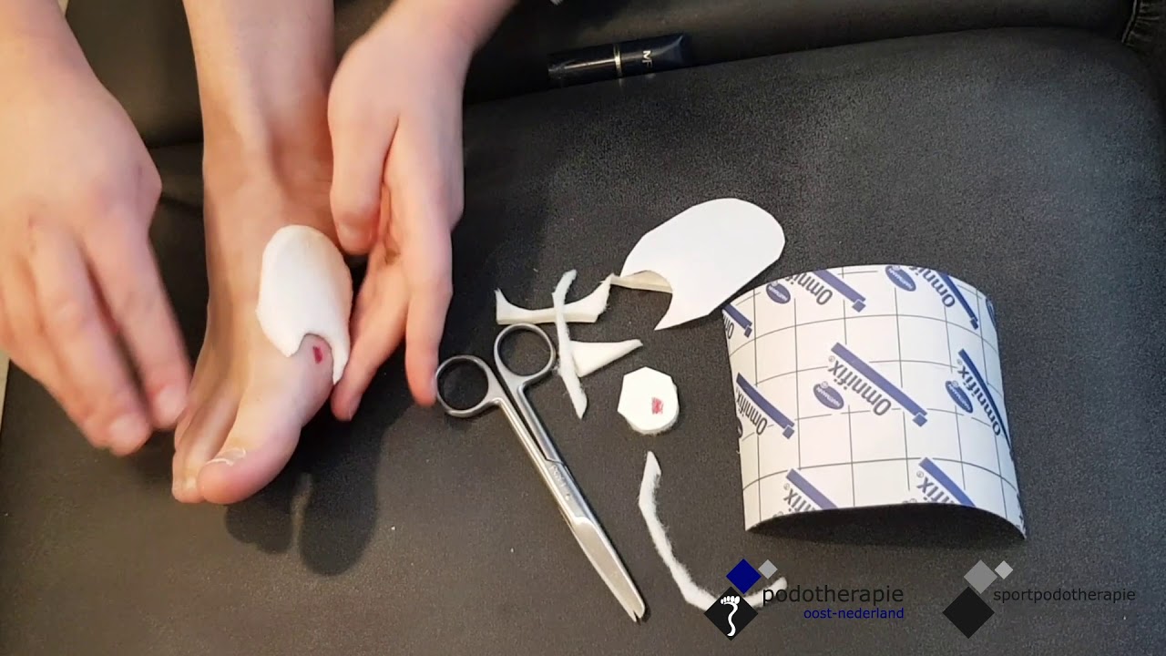 Zelfzorg bij drukplekken op je voet - Podotherapie Oost-Nederland