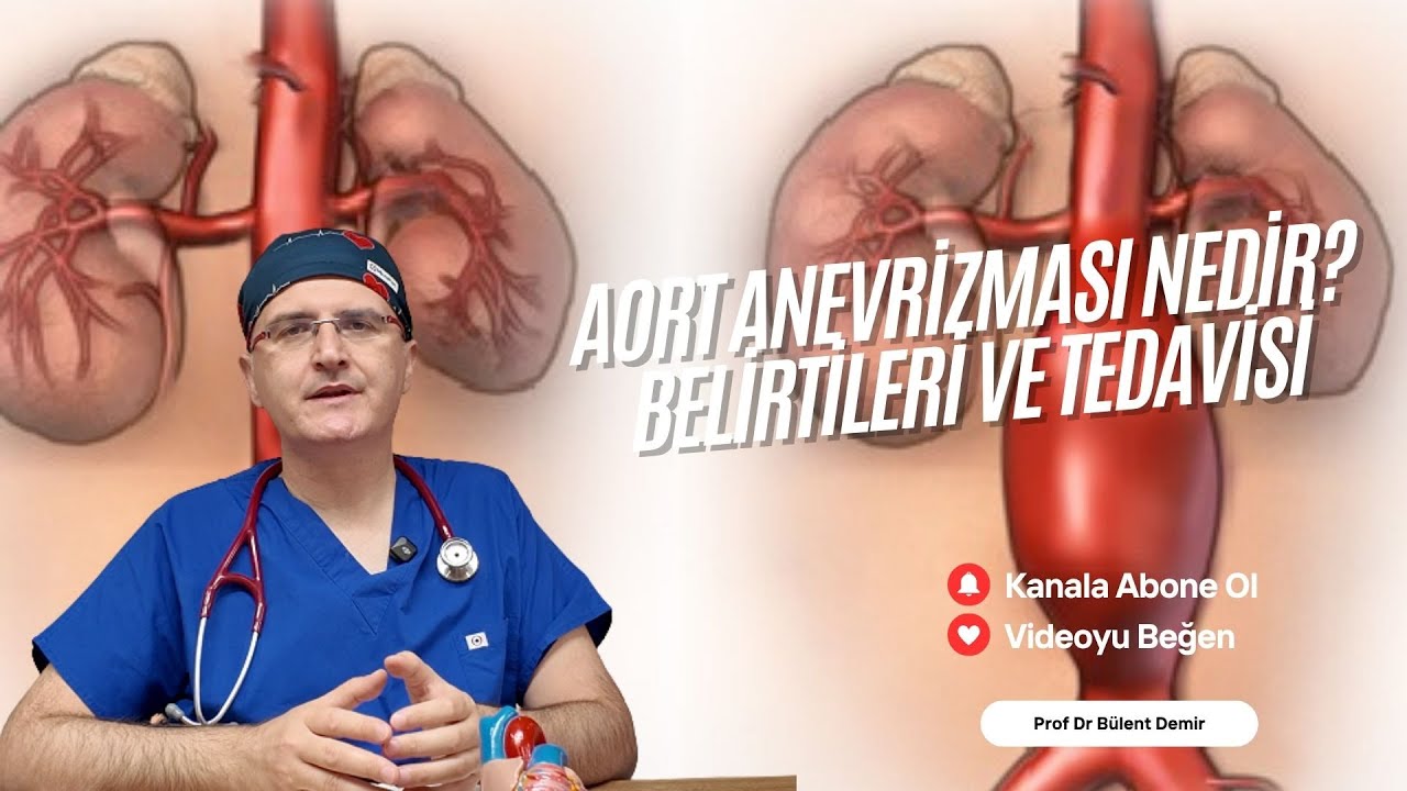 Aort Anevrizması Nedir? Belirtileri ve Tedavisi