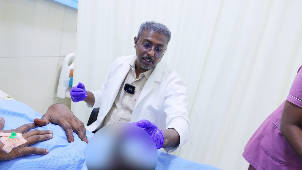 Indian Malleable Penile Implant Surgery | Best Results & Patient Satisfaction