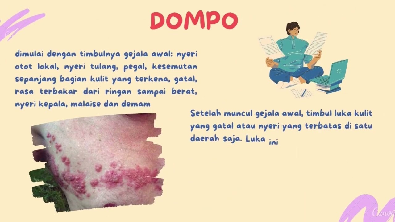 Dompo atau Tomcat ya ? sudah tau perbedaanya ?