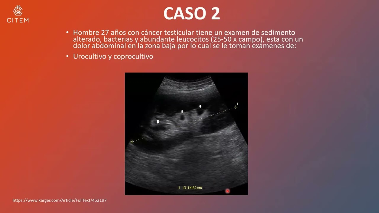 Taller 2 Casos Clinicos de Bacteriologia