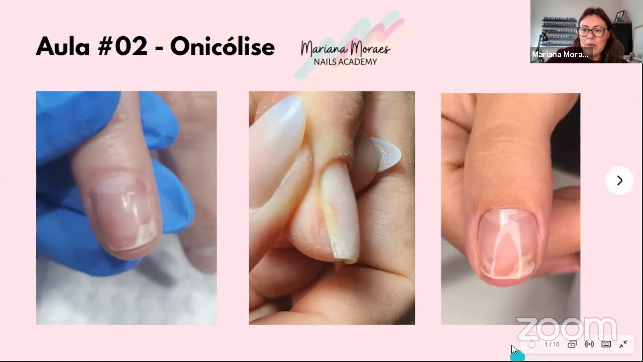 #002 Aulão - Onicólise e saúde das unhas
