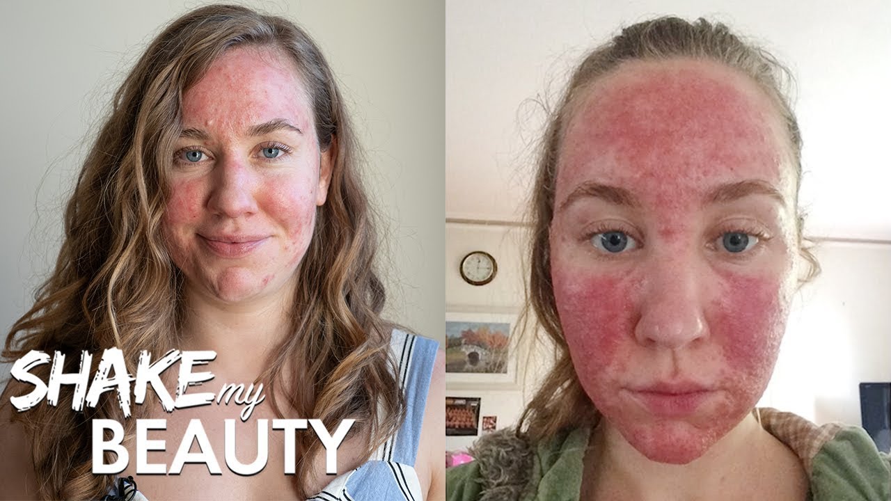 I Couldn't Look At Myself In The Mirror - Until Now | SHAKE MY BEAUTY