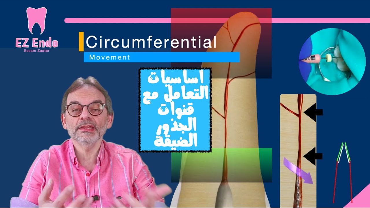 خطوات التعامل مع قنوات الجذور الضيقة Steps of negotiating narrow root canals