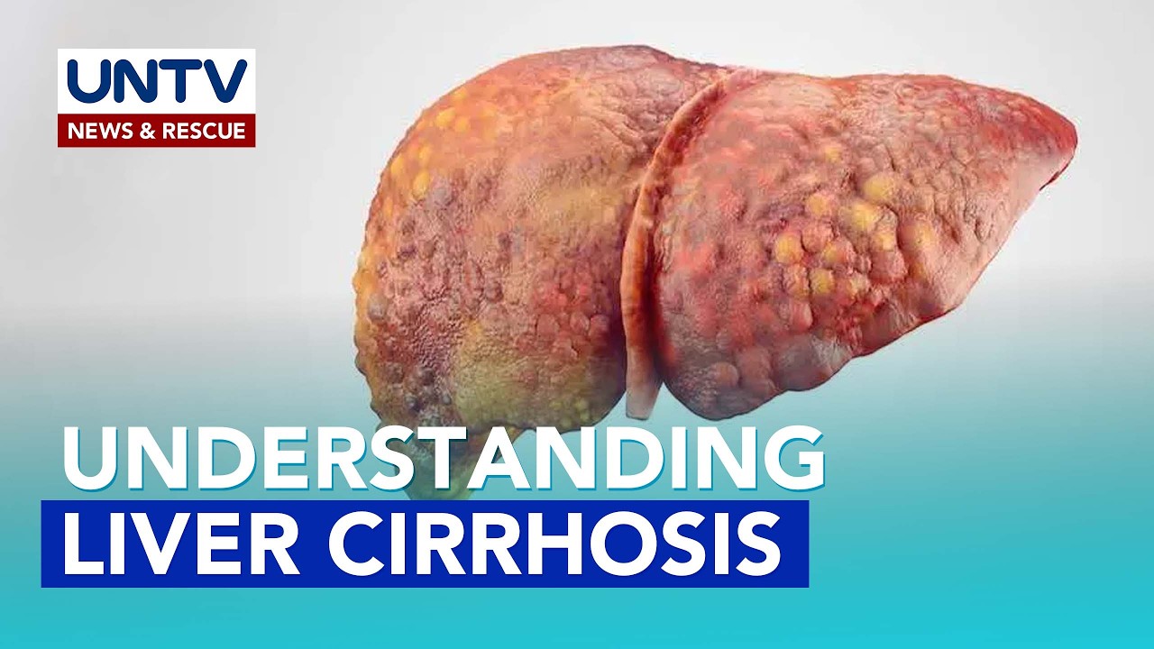 Liver Cirrhosis: Causes and Risk Factors explained by medical experts