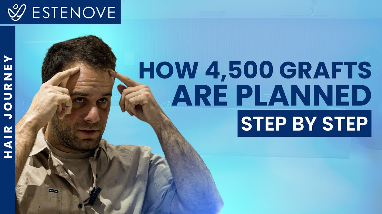 What Is a Hair Transplant Consultation Like in Turkey? ✅