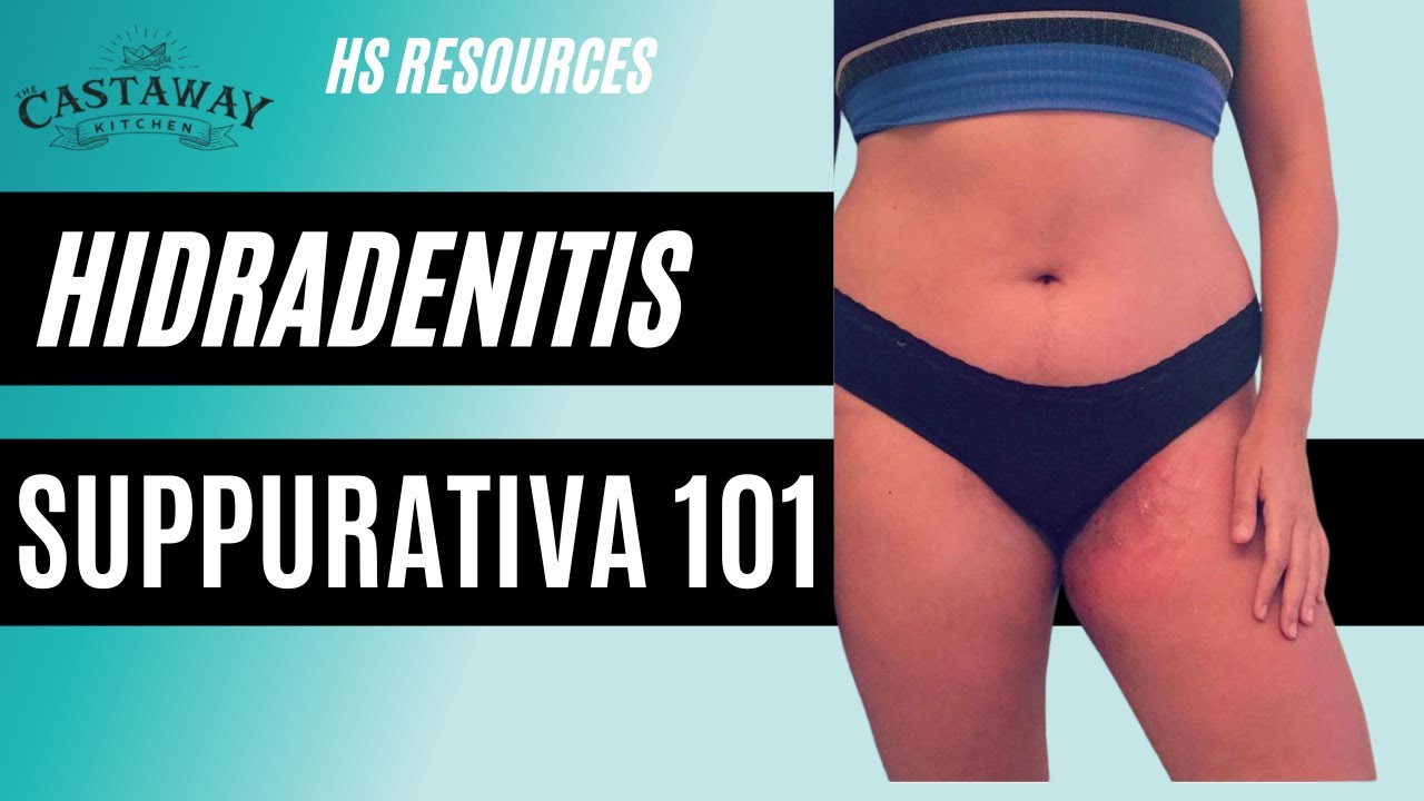 Hidradenitis Suppurativa 101
