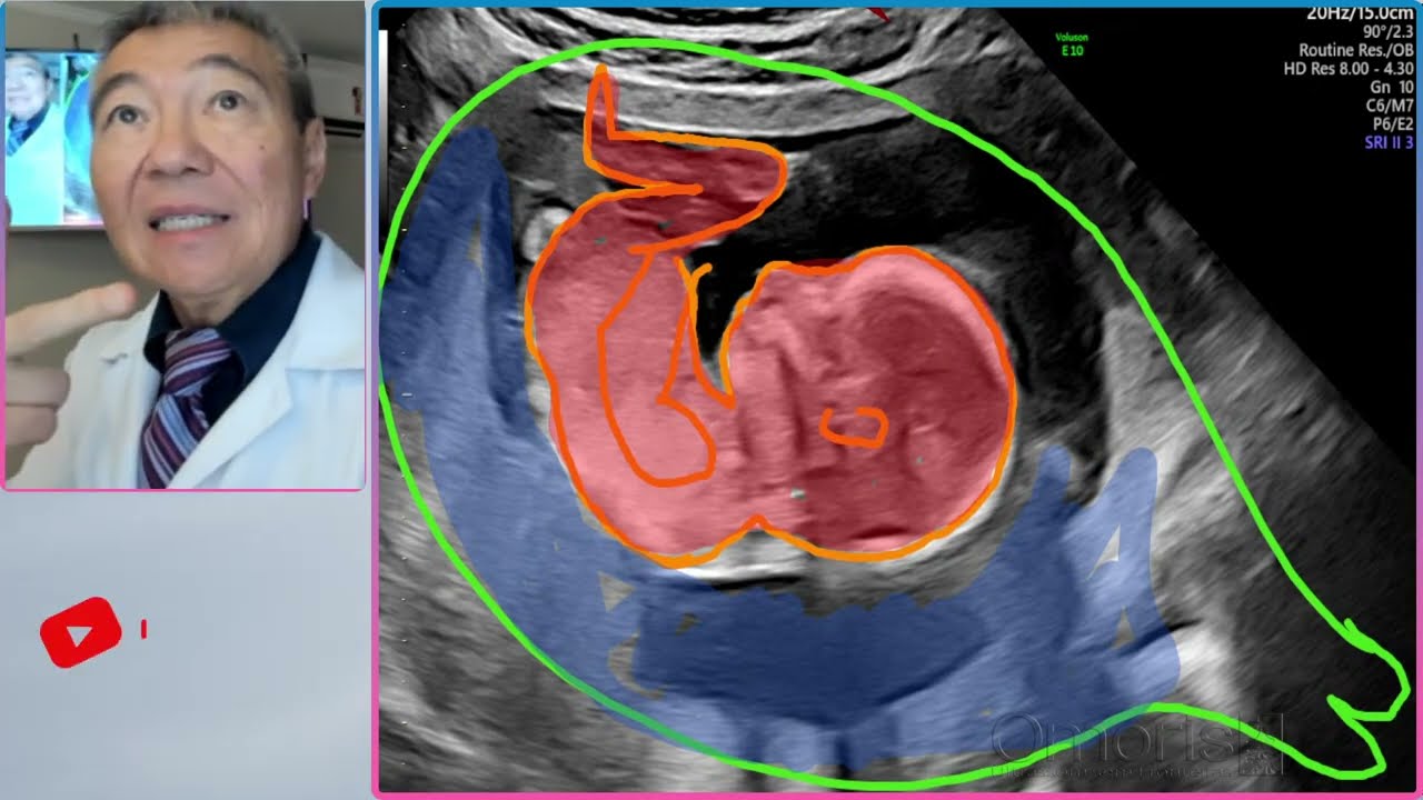 Baby gender reveal at 15 weeks pregnant