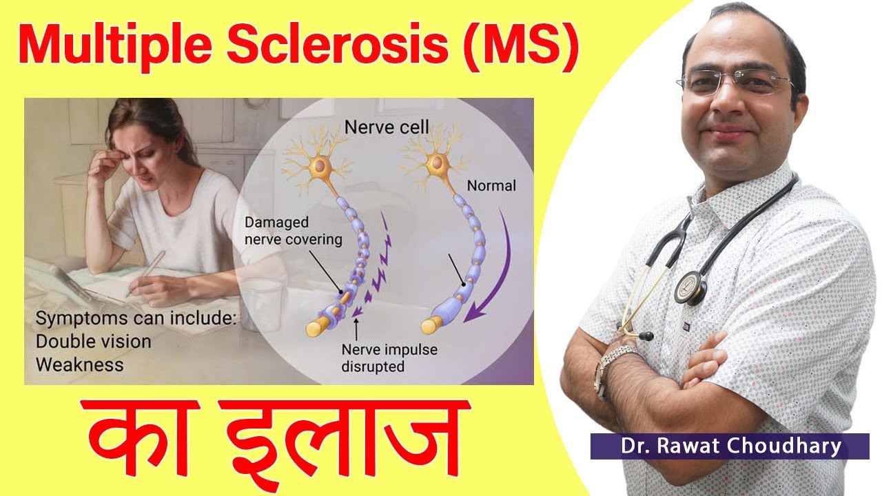 Multiple Sclerosis | Best Treatment of Multiple Sclerosis (MS) | Best Homeopathic Doctor