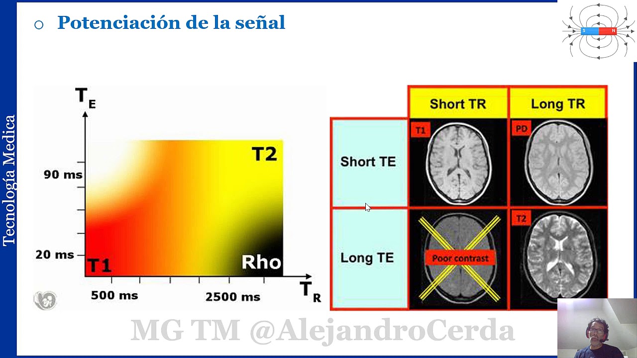 03- secuencia eco de spin