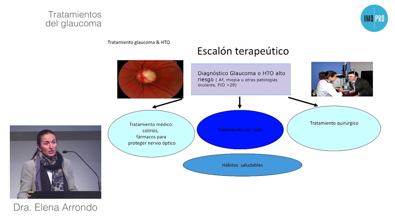 Tratamiento del Glaucoma - Dra. Elena Arrondo