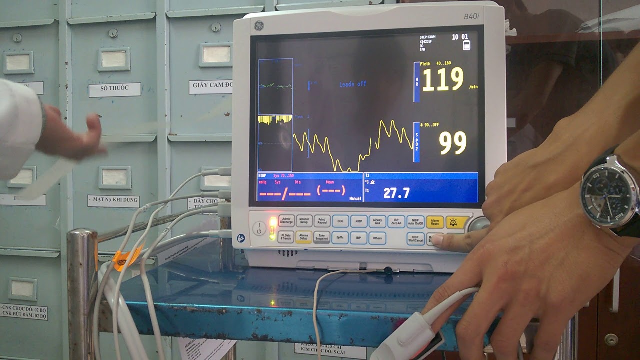 Monitor B40i  (**Beta Version**)