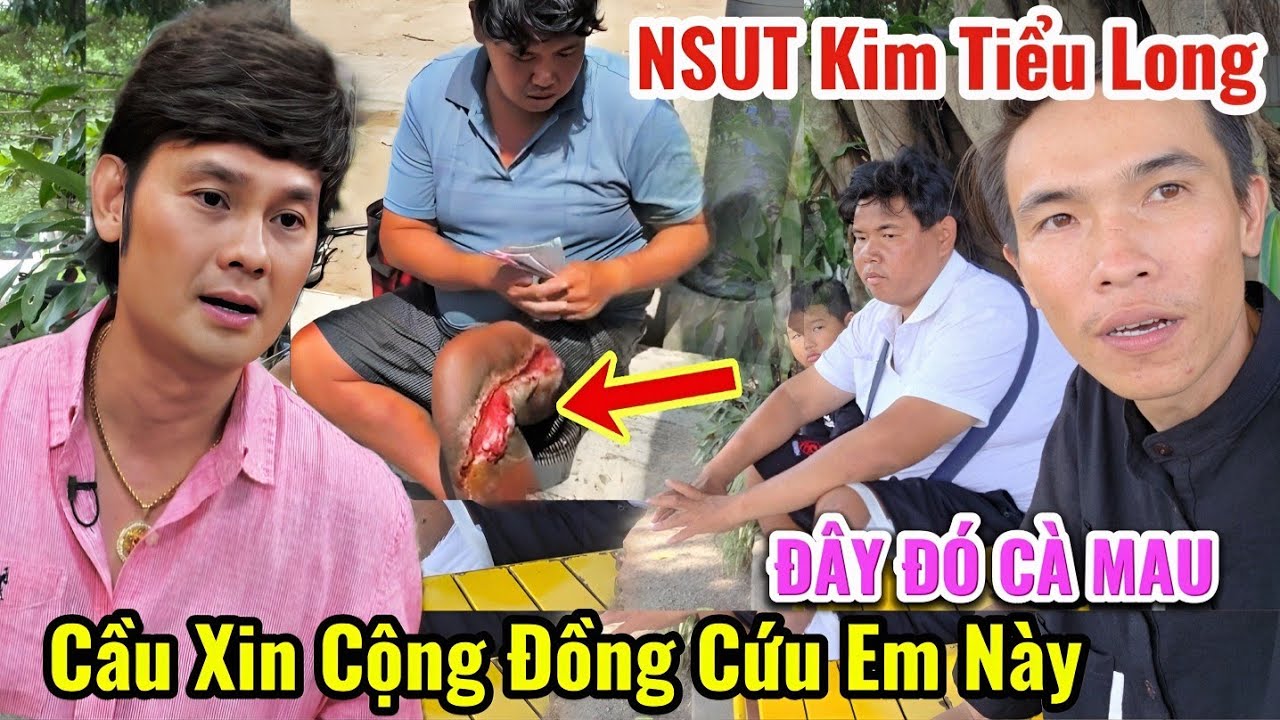 Cầu Cứu Gấp ĐÂY ĐÓ CÀ MAU 👈Hoại Tử Chân 