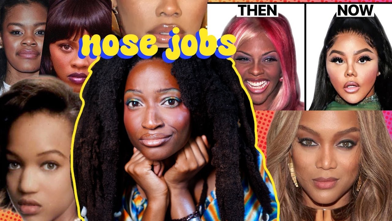 Does Changing your Nose mean You'll Have More 