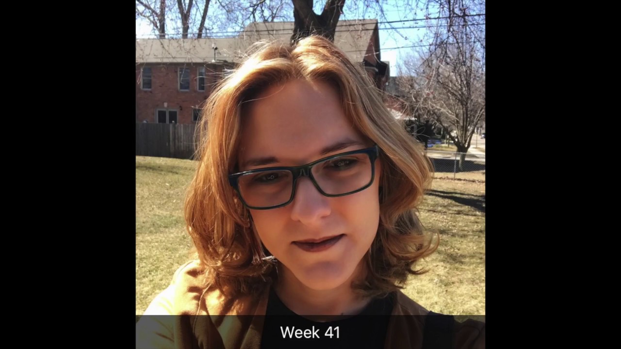 First Year of HRT! Before and After!