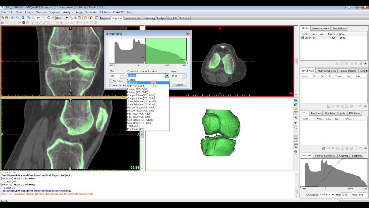 Tutorial: Mimics Innovation Suite - Thresholding