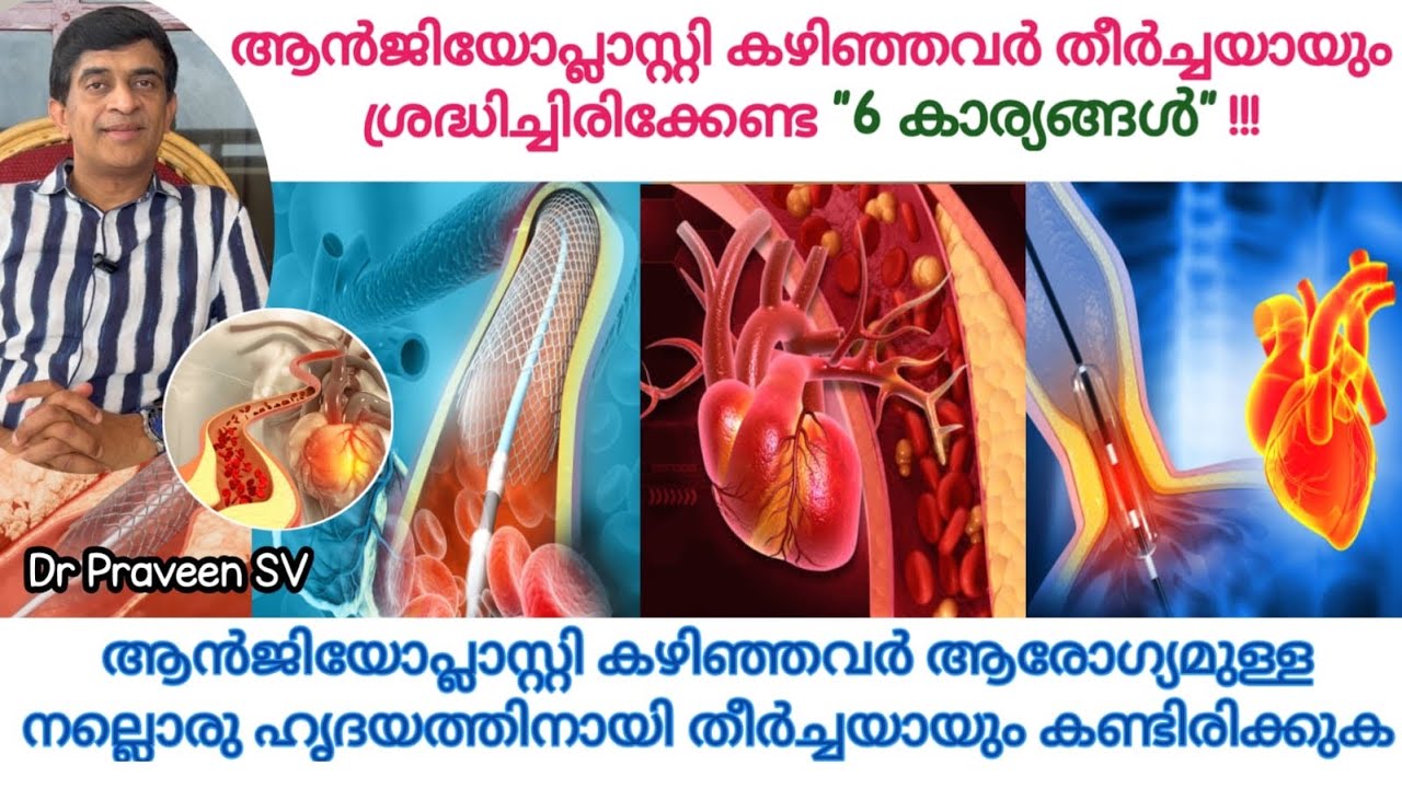 6 points to care after angioplasty|Care after angioplasty malayalam|Angioplasty malayalam|Dr Praveen