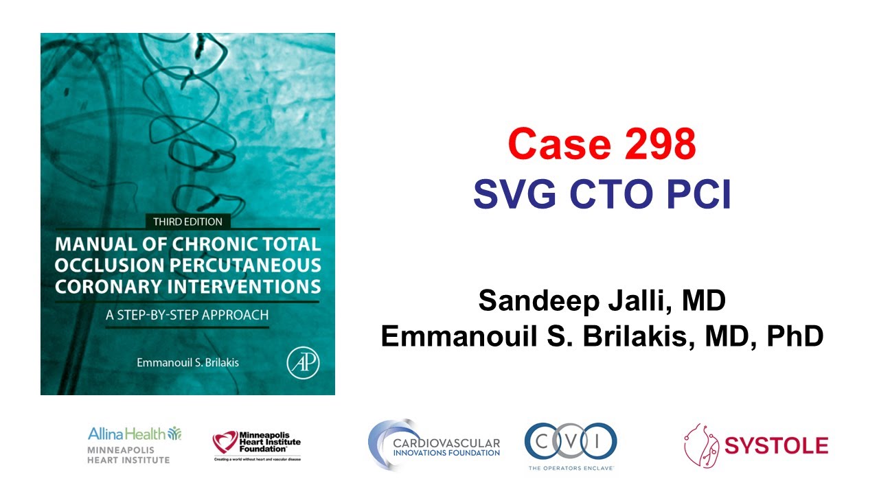 Дело 298: Руководство CTO PCI - SVG CTO PCI