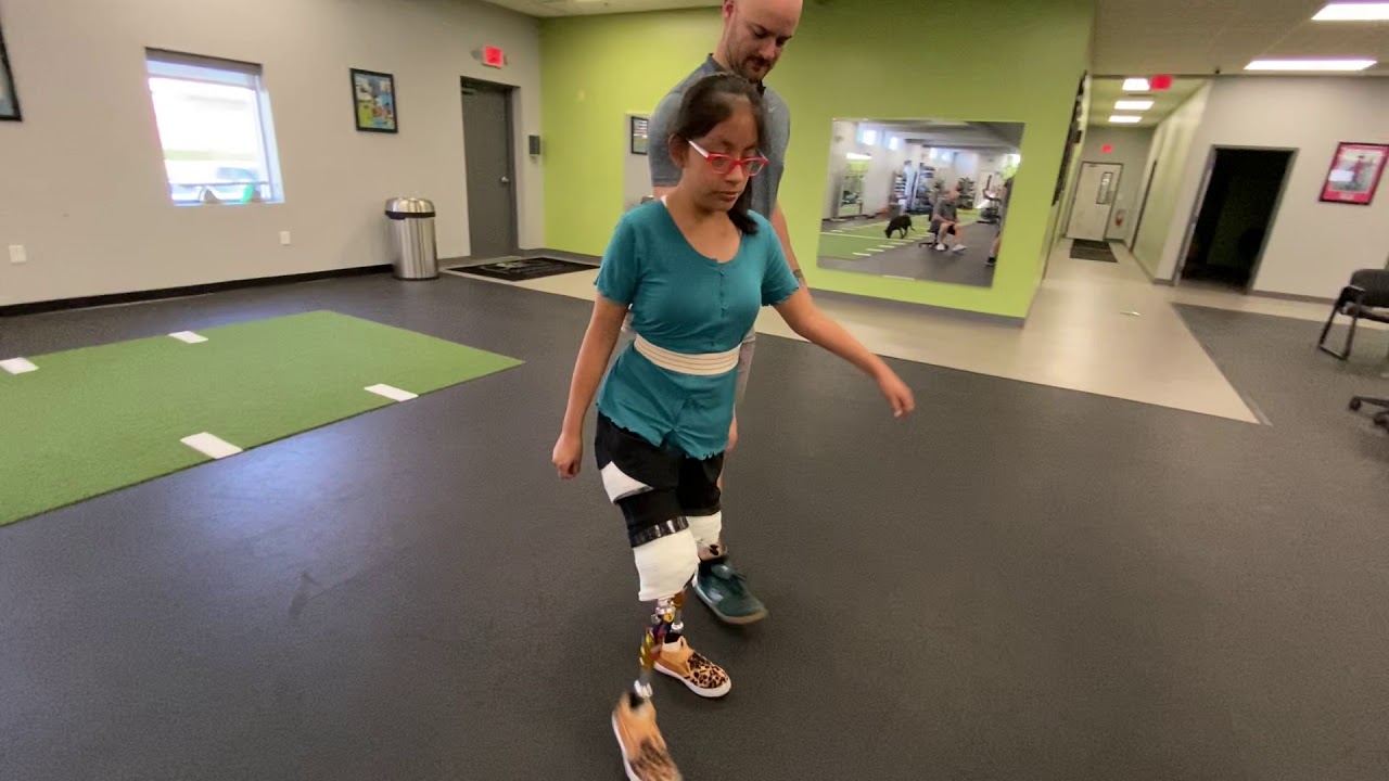 Rosa, bilateral AK amputee, walking independently!