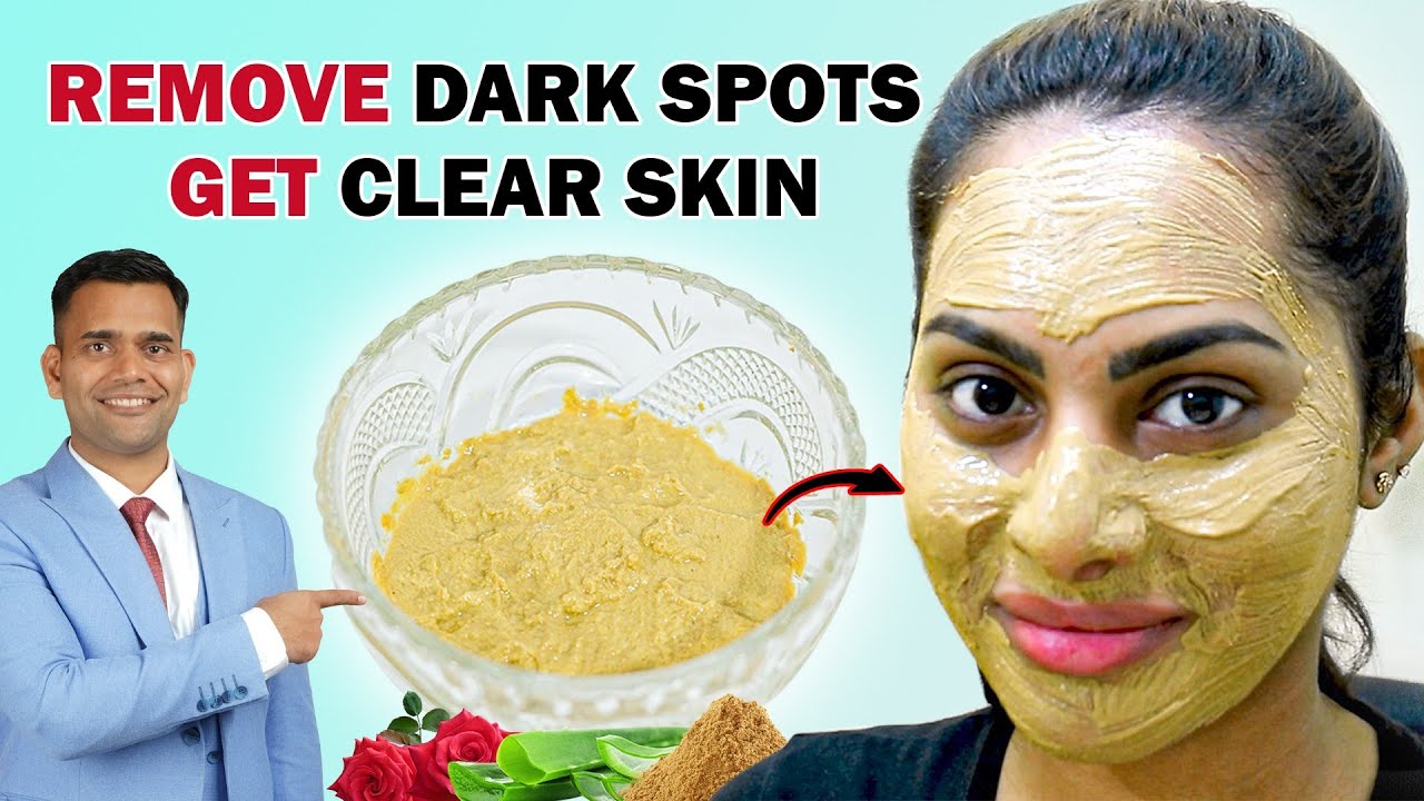 Remove Dark Spots and Get Clear Skin Naturally At Home - Dr. Vivek Joshi