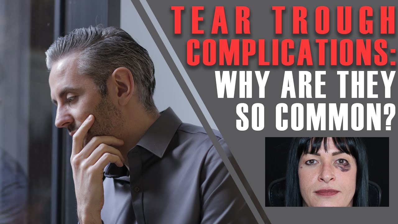 Tear Trough Complications: Why Are They So COMMON? [Aesthetics Mastery Show]