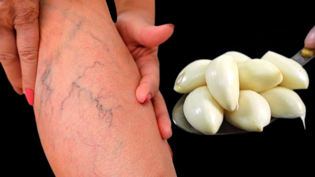 Боль в ногах, ревматизм, варикозное расширение вен, артрит, головная боль, боль в суставах.