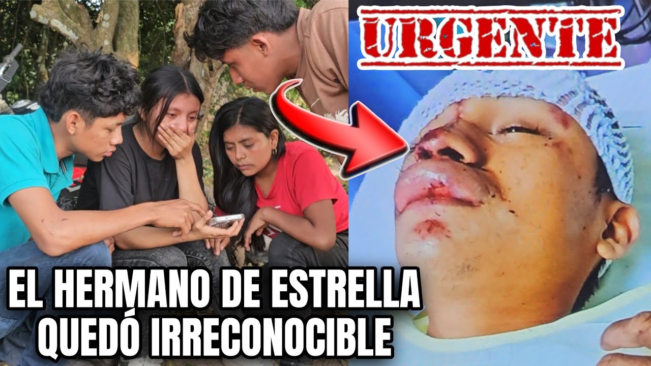 Santo Dios Así Le Quedó La Cara Por El Accidente😭 Estrella No Podía Creer 