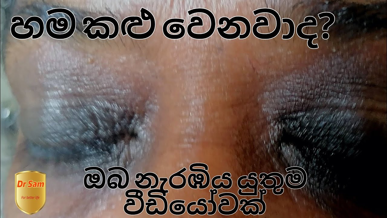 හම කළු වෙන්නට නියම හේතුව මෙන්න..Real cause for darkening of the skin