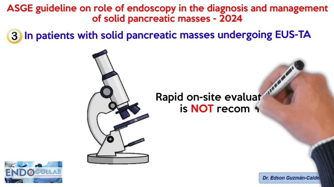 ASGE Guideline on role of endoscopy in the diagnosis and management of solid pancreatic masses- 2024