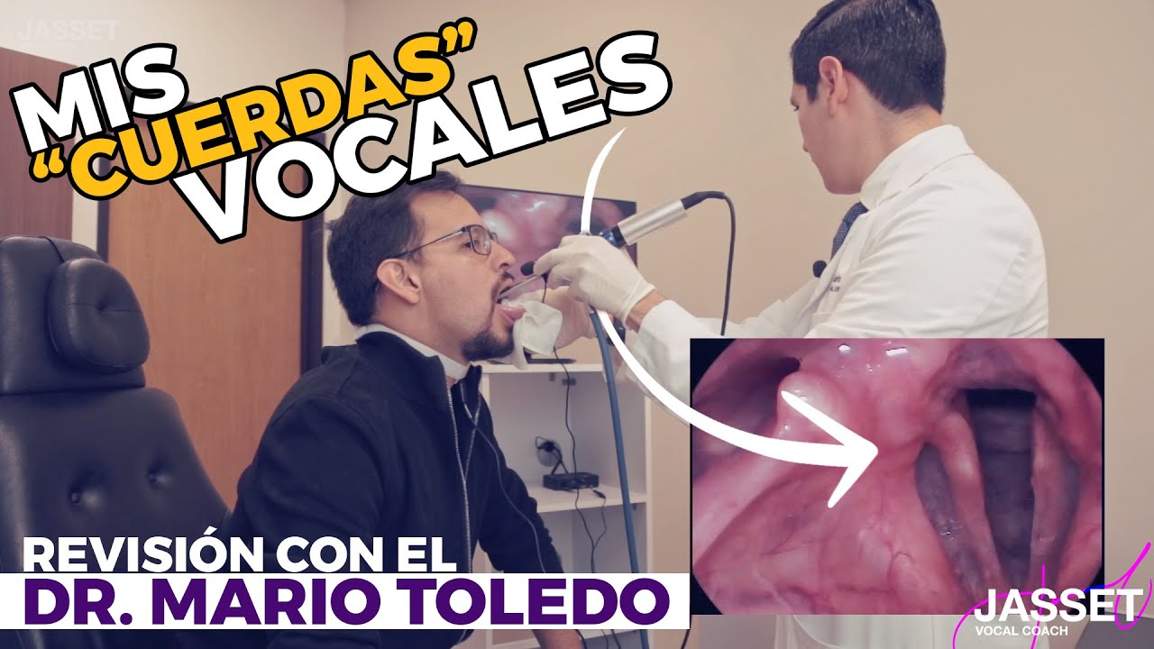 REVISIÓN VOCAL -  Mis 