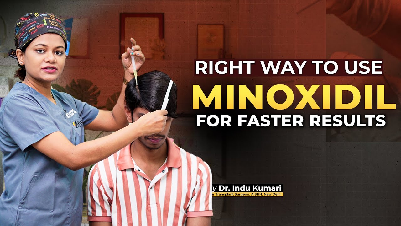 Correct Way to Use Minoxidil in 2025| Minoxidil 5 % Ka Use Kaise Kare| Minoxidil For Thinning Hair