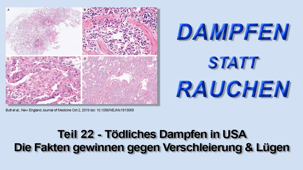 Dampfen statt Rauchen Teil 22 - T&ouml;dliches Dampfen in USA (Teil 3)