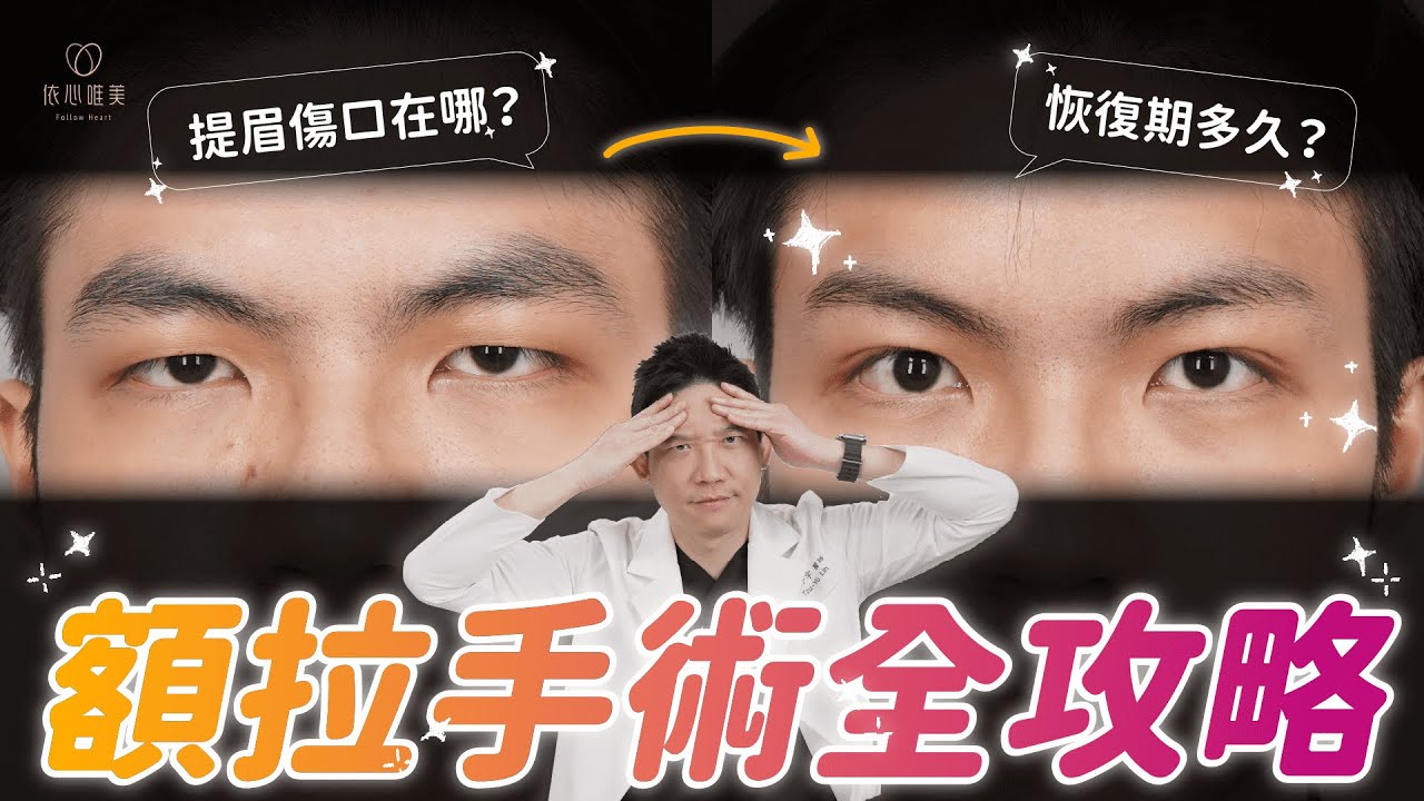 天生眉毛近？不該只考慮雙眼皮手術！五爪額拉是什麼？內視鏡額拉提眉手術拯救下垂眉壓眼｜依心唯美 林子宇醫師