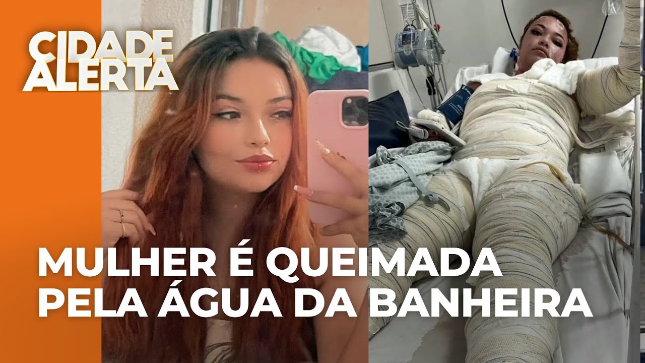 Mulher vai a motel com 'ficante' e acaba morta; vítima teve o corpo queimado com água da banheira