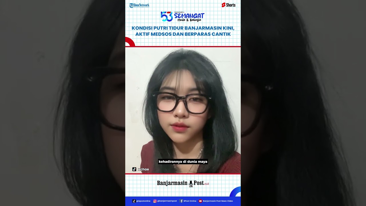 Putri Tidur dari Banjarmasin Ungkap Kondisi Terkini, Punya Paras Cantik dan Masih Sering Begadang